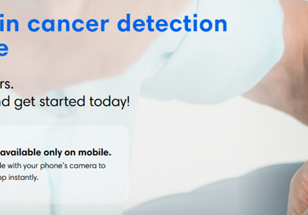 KI-basierte Hautkrebs-App - SkinVision
