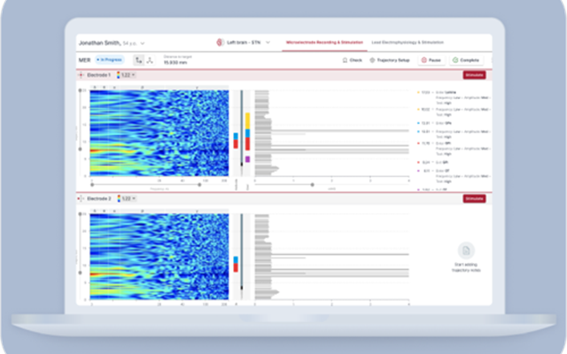 Cadabra Studio Projekt - Neurochirurgische Instrumente neu gestalten